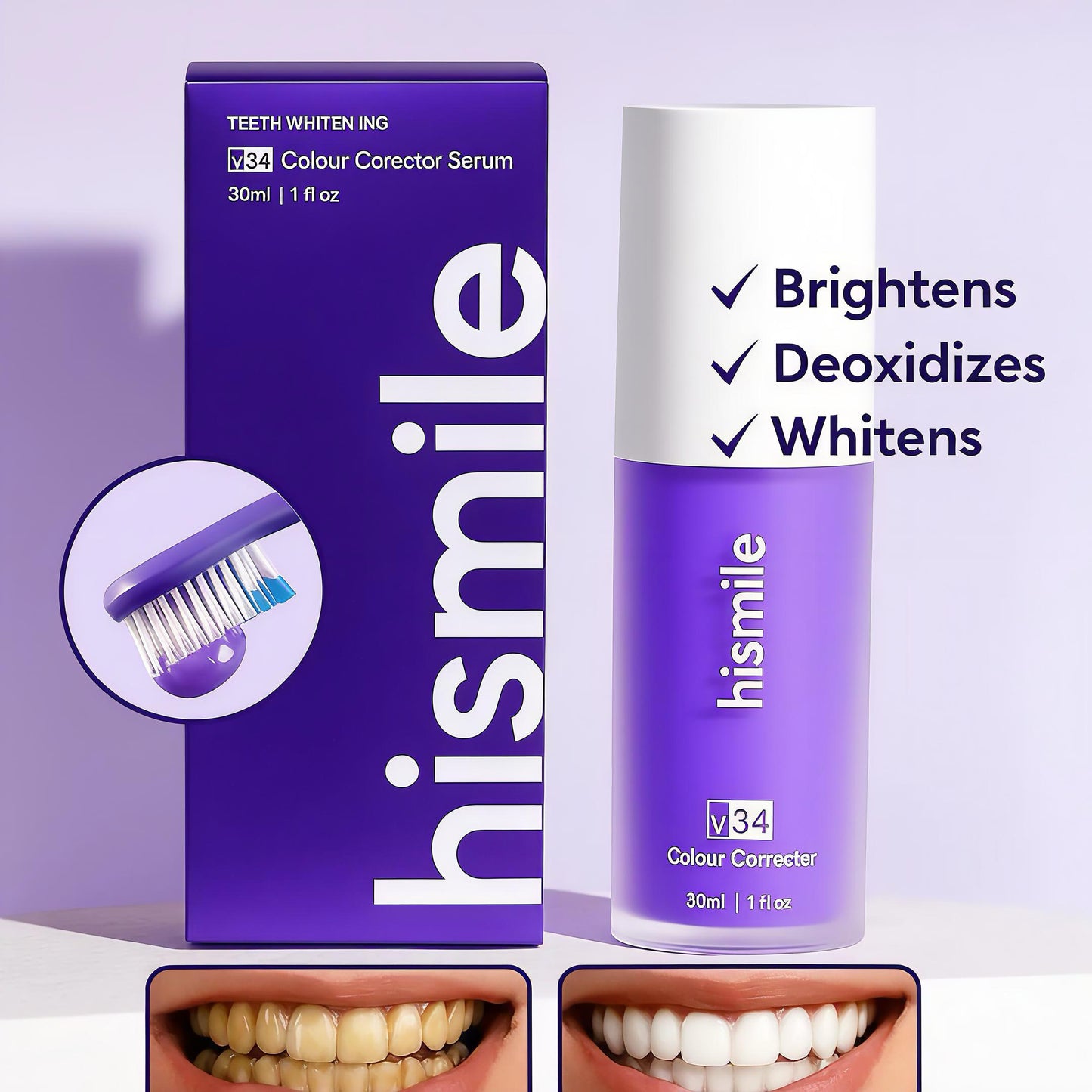 The Ultimate Instant Teeth Whitening Solution