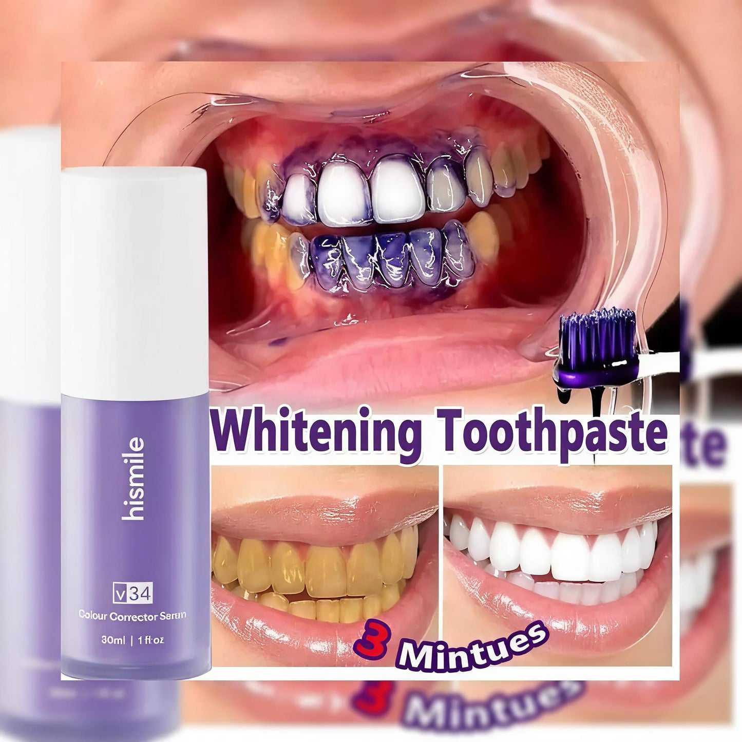 The Ultimate Instant Teeth Whitening Solution